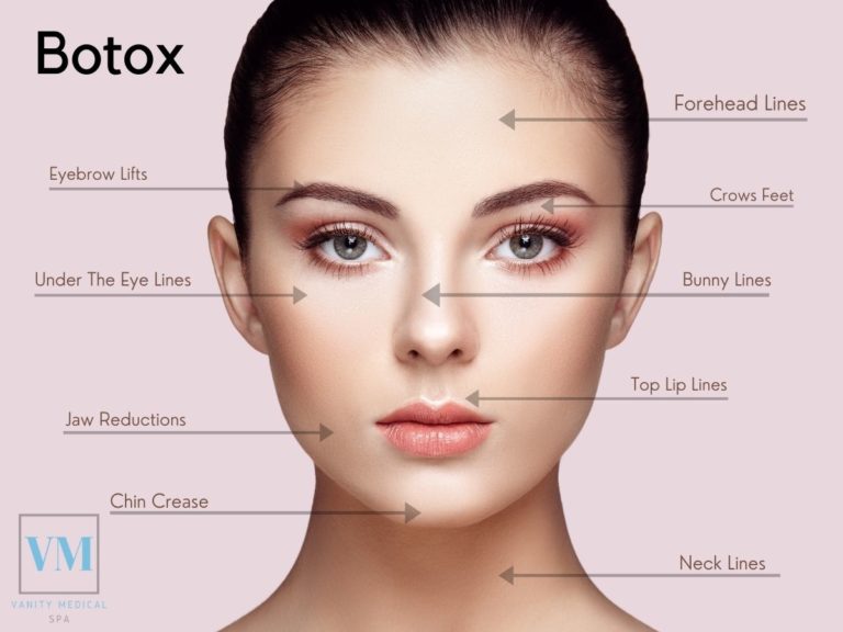 Botox Treatment in Teaneck, NJ. Call Vanity Medical Spa Now