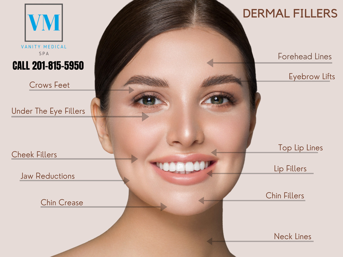 Dermal Fillers: HA Fillers + Belotero + Radiesse - Vanity Medical Spa