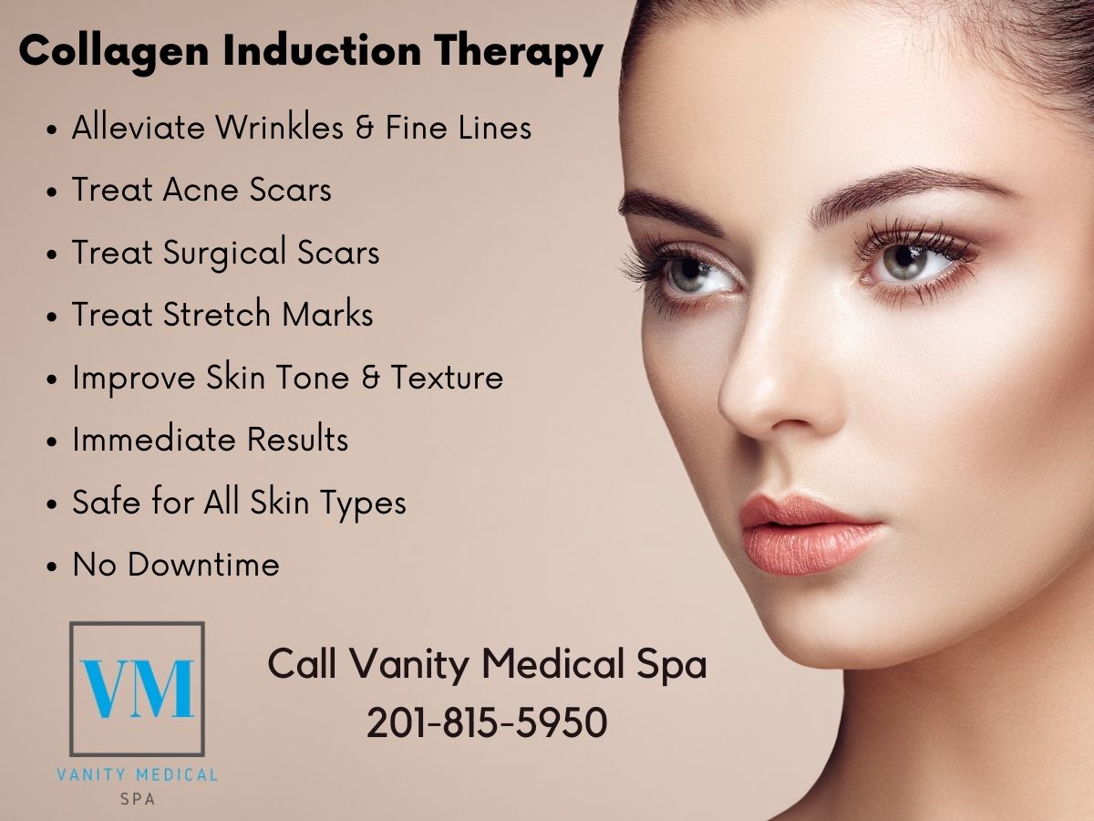 Microneedling Collagen Induction Therapy - Vanity Medical Spa