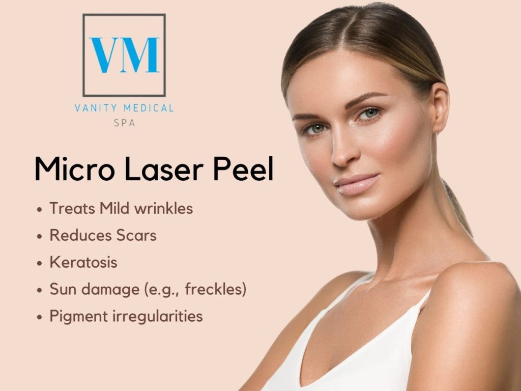 Erbium Micro Laser Peel: Skin Resurfacing Treatment | Vanity Medical Spa