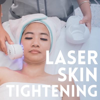 Laser Skin Tightening