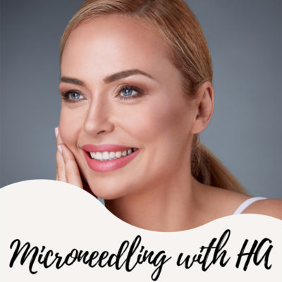 Microneedling with Hyaluronic Acid