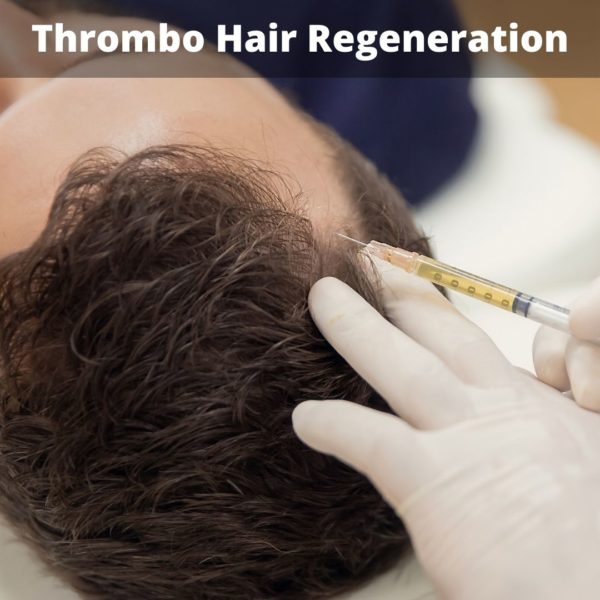 Thrombo hair regeneration