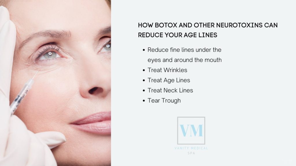 How Botox and Other Neurotoxins Can Reduce Your Age Lines