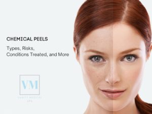 Chemical Peels: Types, Risks, Conditions Treated,