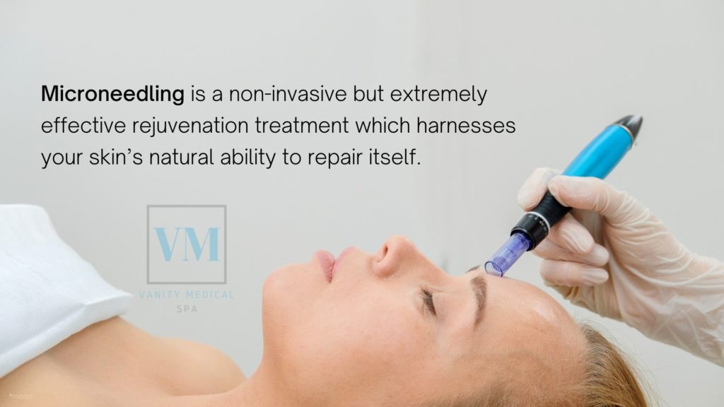 Microneedling Services in Teaneck, NJ