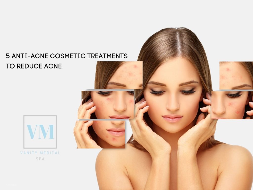 5 Anti-Acne Cosmetic Treatments to Reduce Acne