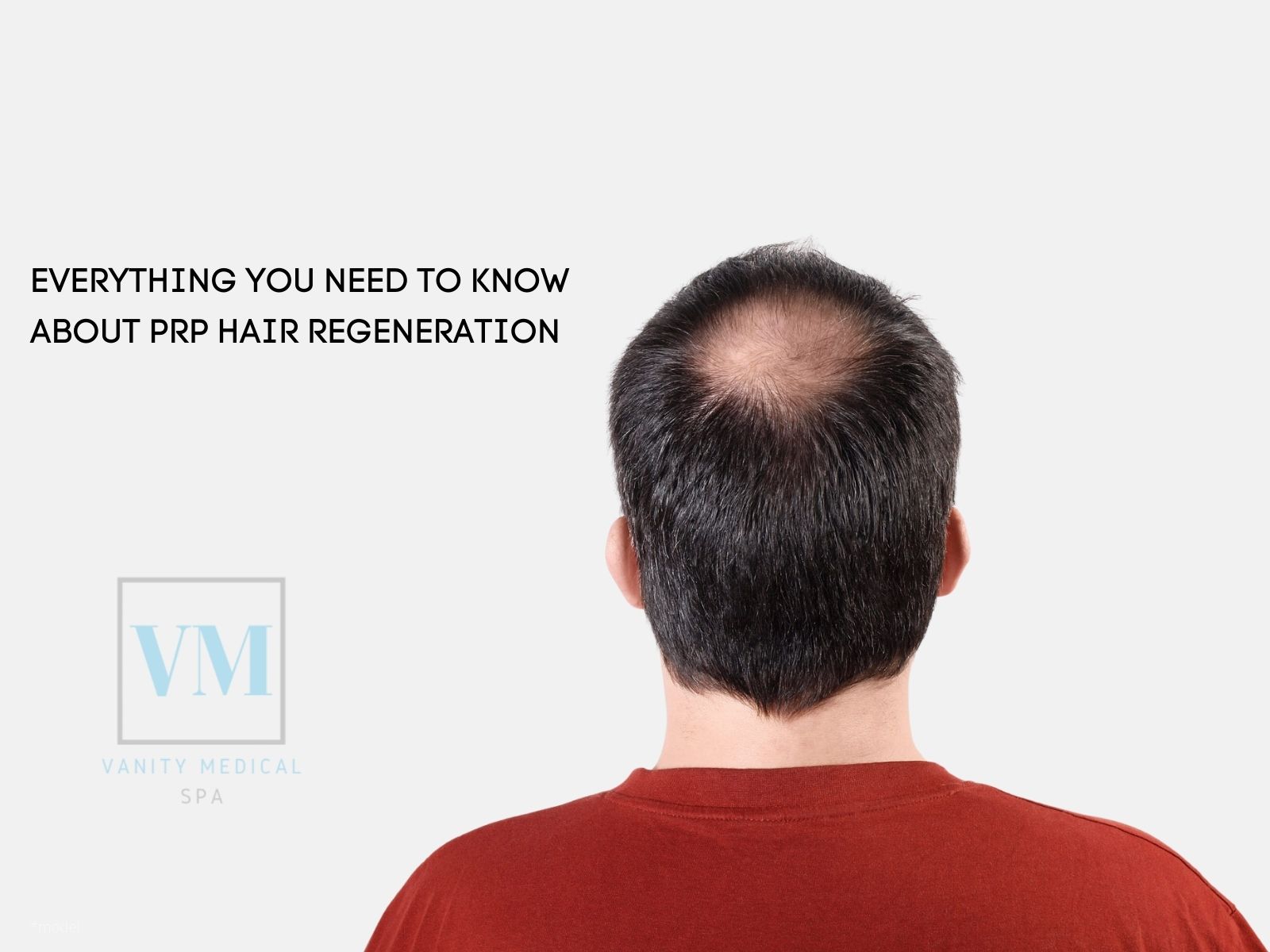 Everything You Need to Know About PRP Hair Regeneration