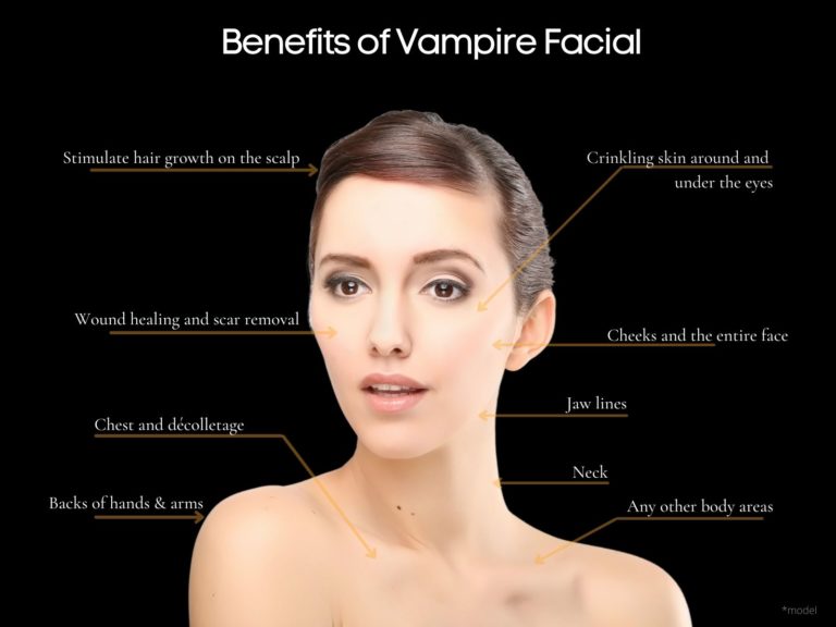 Vampire Facial: What Is It, Benefits & How Does It Help?