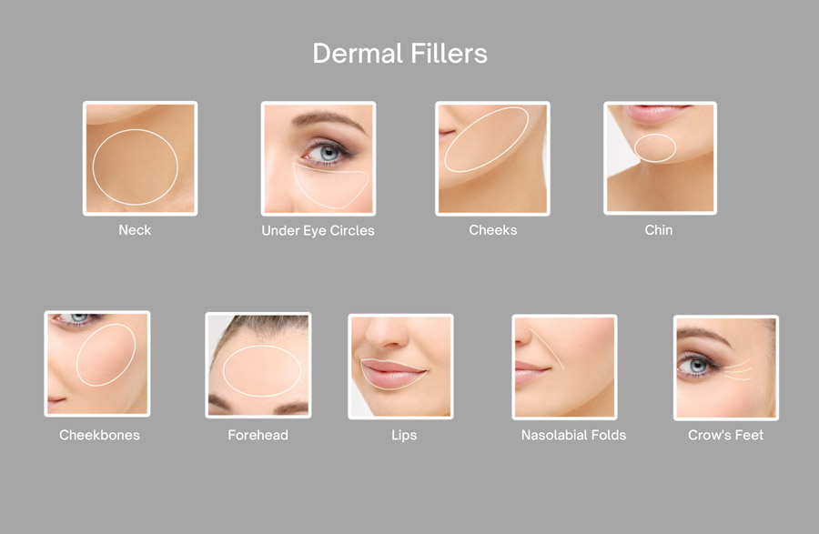 Dermal Fillers - Refreshes Your Appearance 