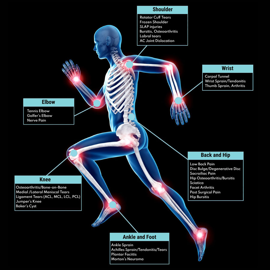 PRP for Joints