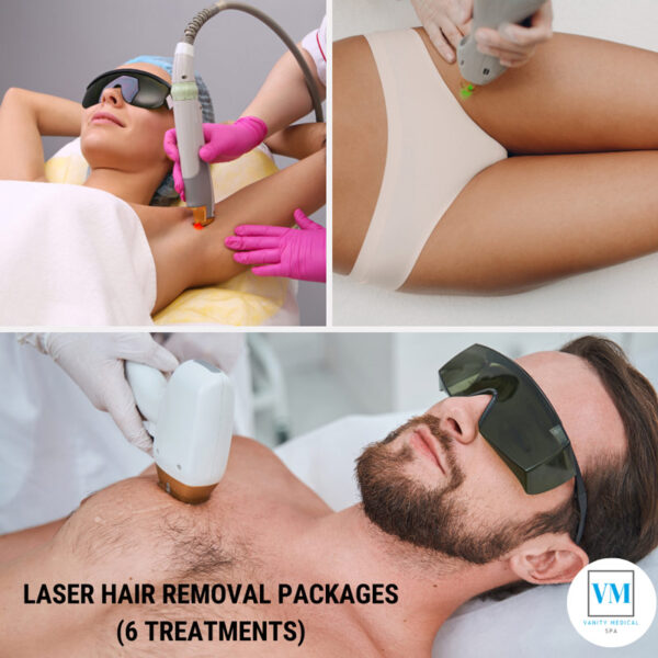 Laser Hair Removal Packages