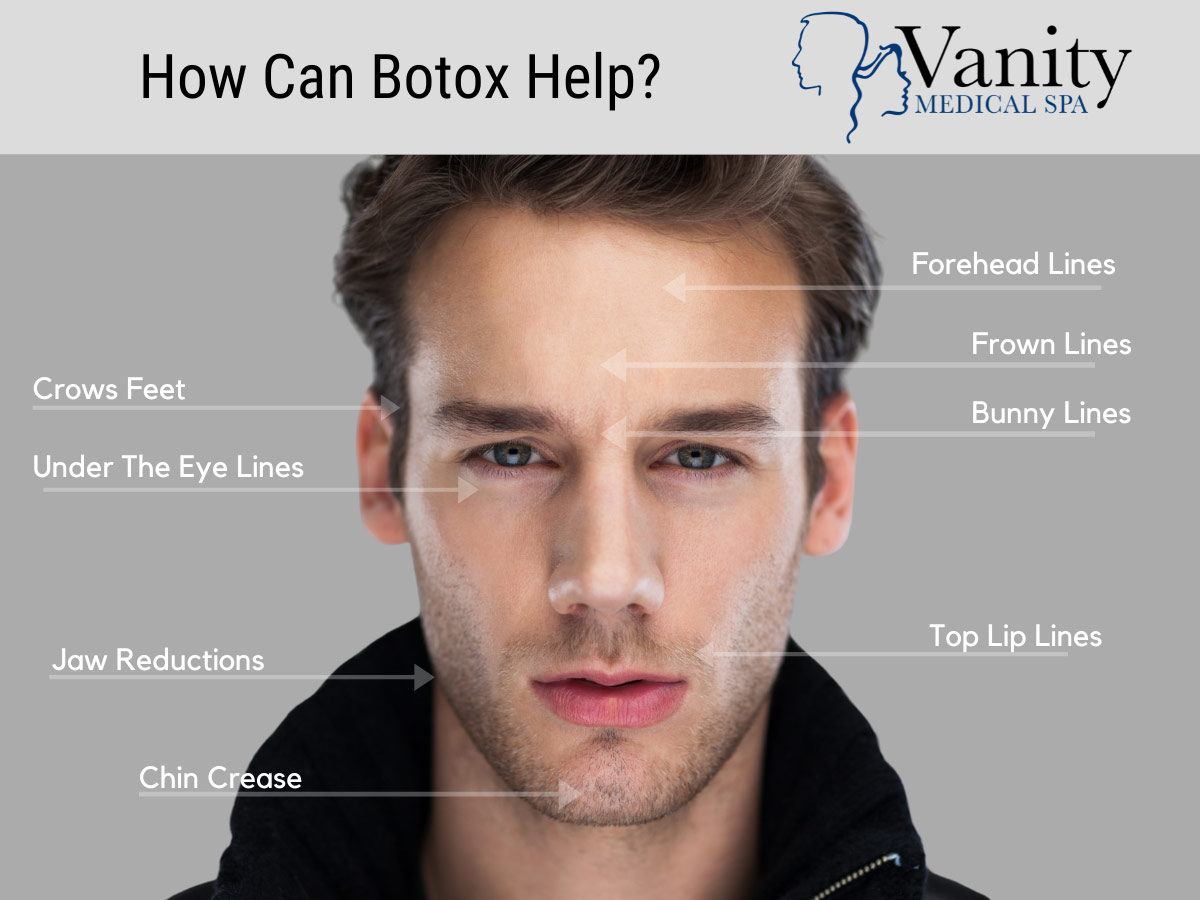 Botox for Men