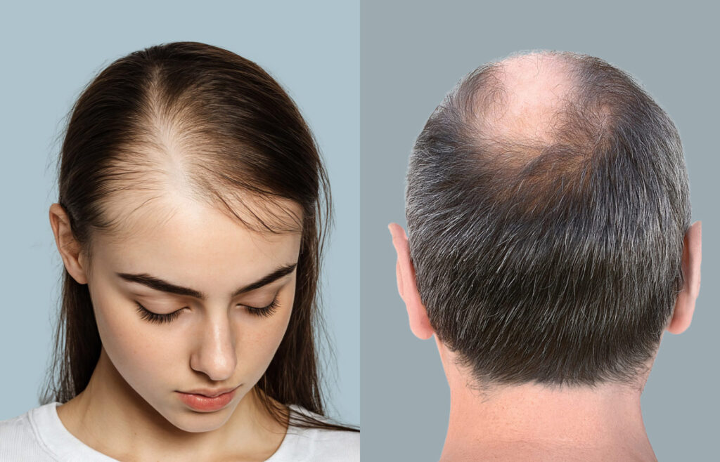 Hair Loss Treatments in Paramus, NJ