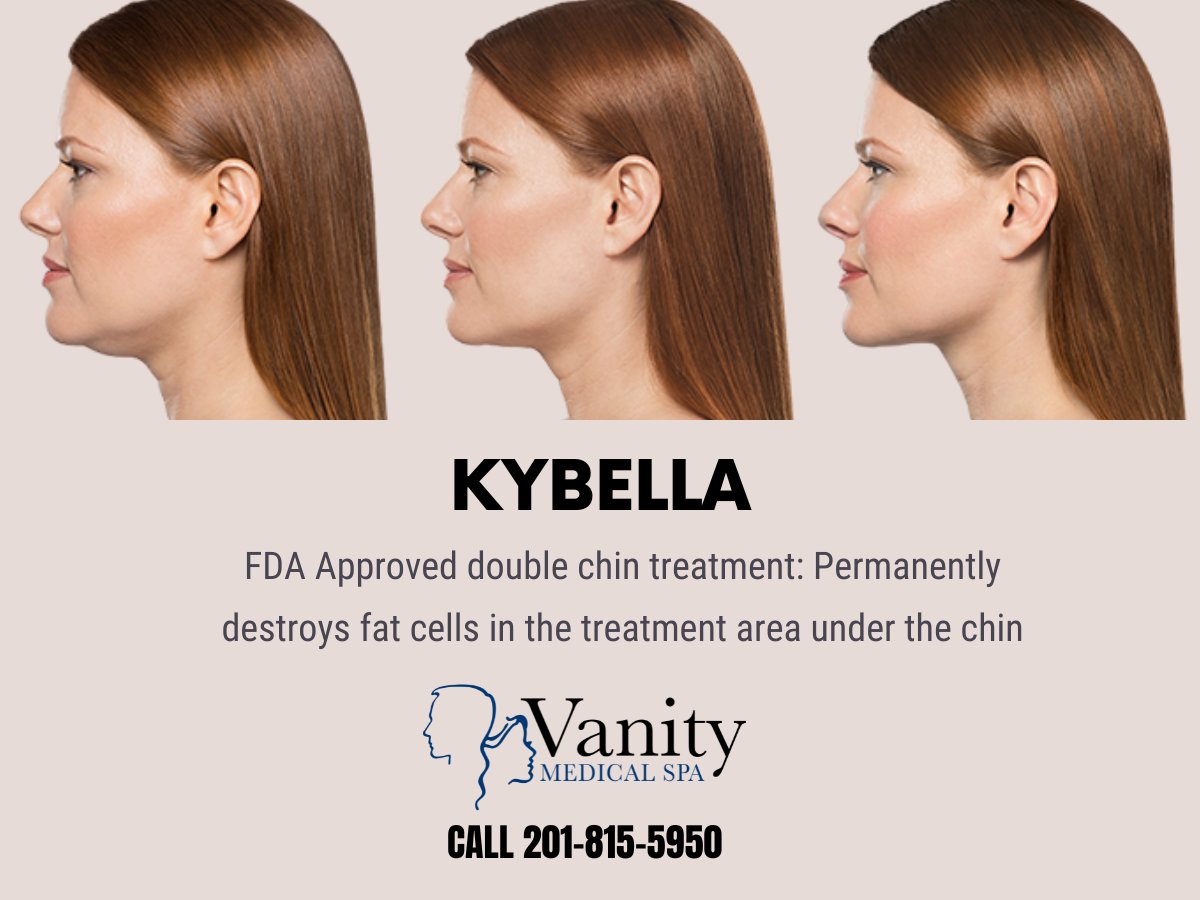 Kybella Double Chin Treatment in Paramus, NJ | Vanity Medical Spa