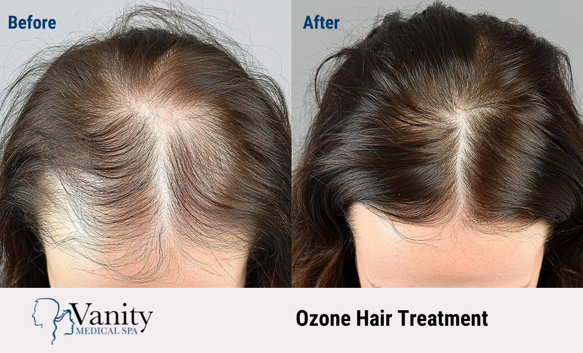 Ozone Hair Treatment before and after
