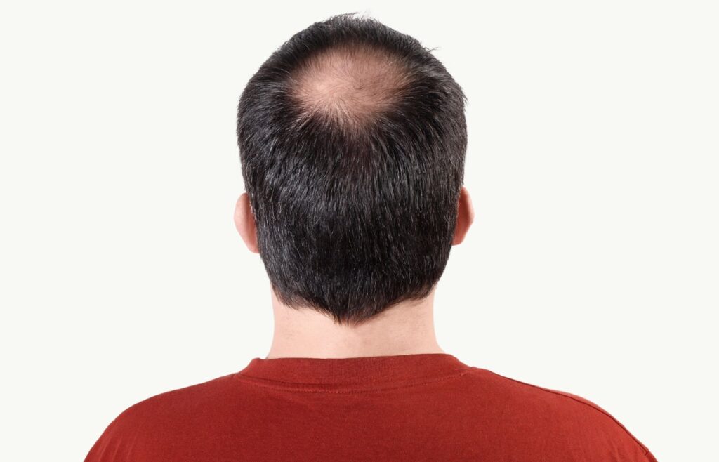 Scalp Therapy at Vanity Medical Spa