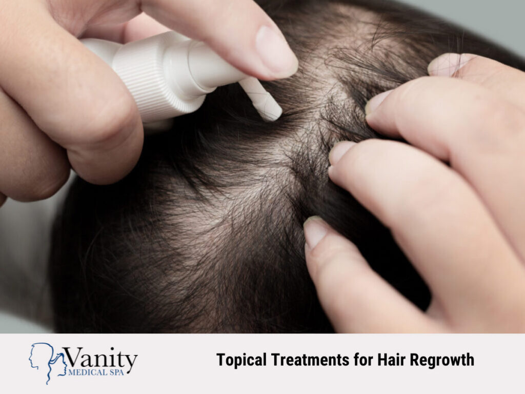 Topical Treatments for Hair Regrowth
