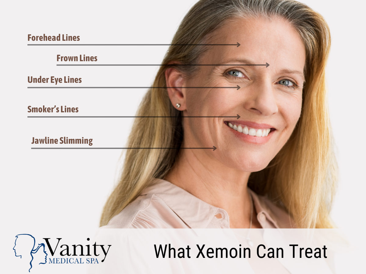 What Xeomin can treat