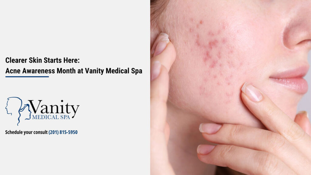 Clearer Skin Starts Here: Acne Awareness Month at Vanity Medical Spa