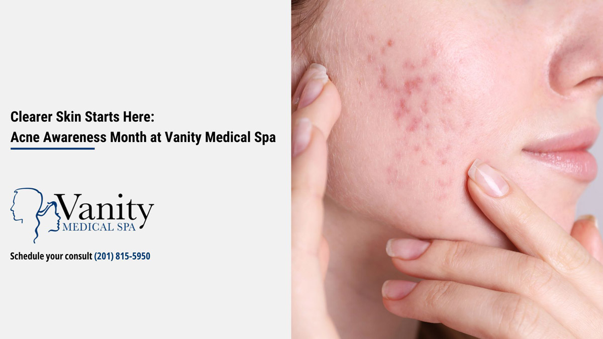 Clearer Skin Starts Here: Acne Awareness Month at Vanity Medical Spa