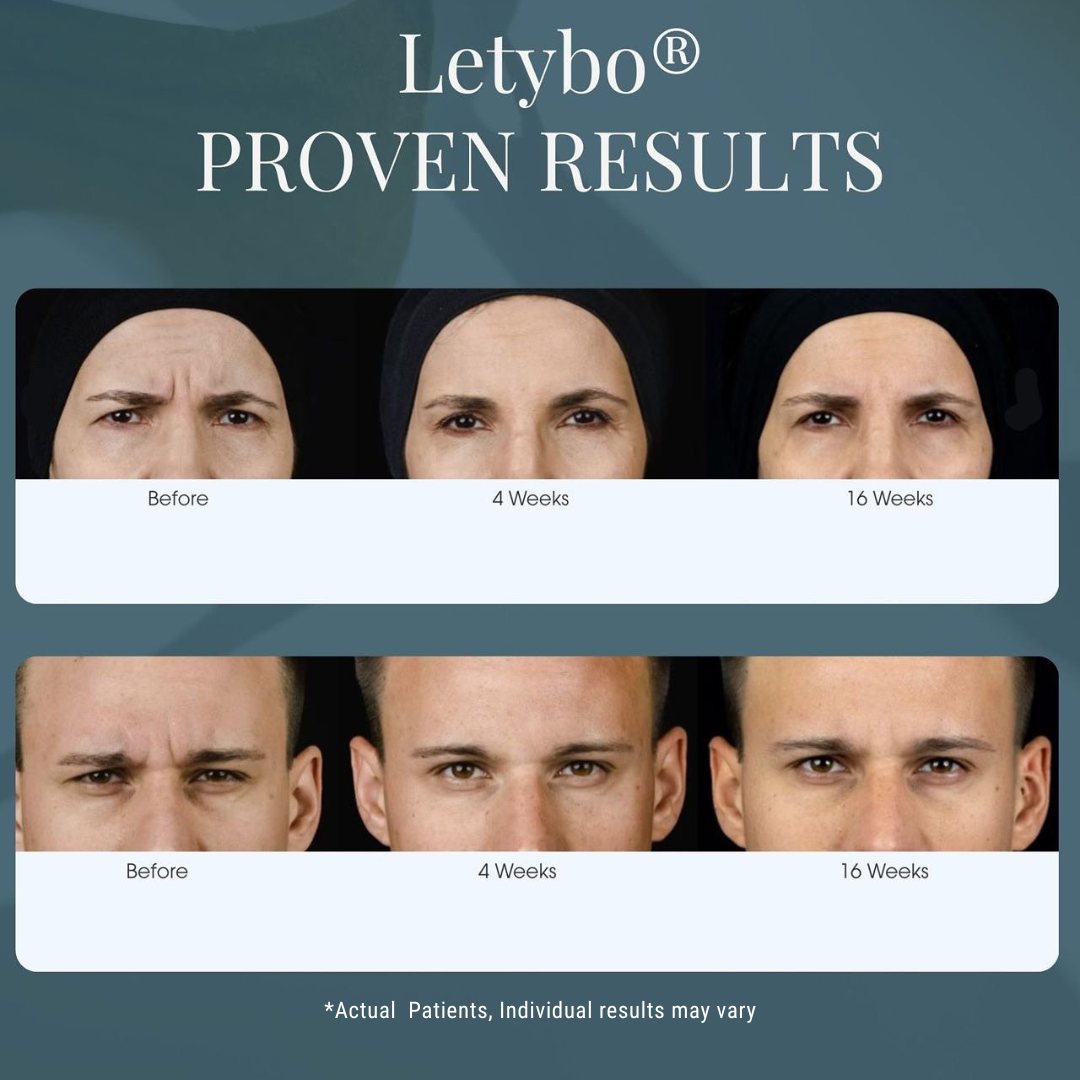 Letybo Before and After