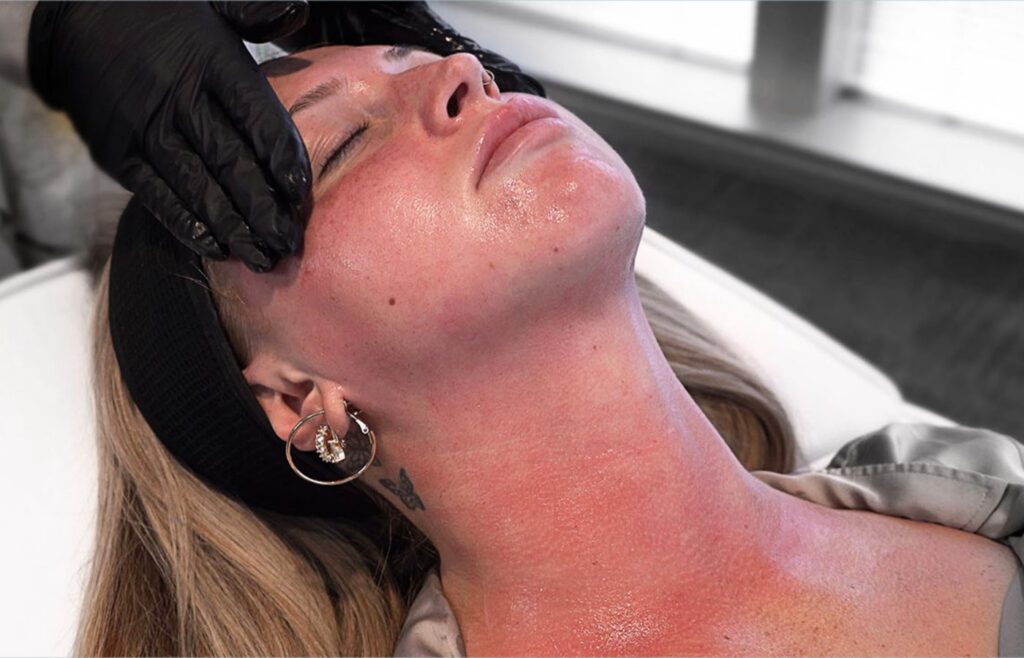 Ariessence Pure PDGF+